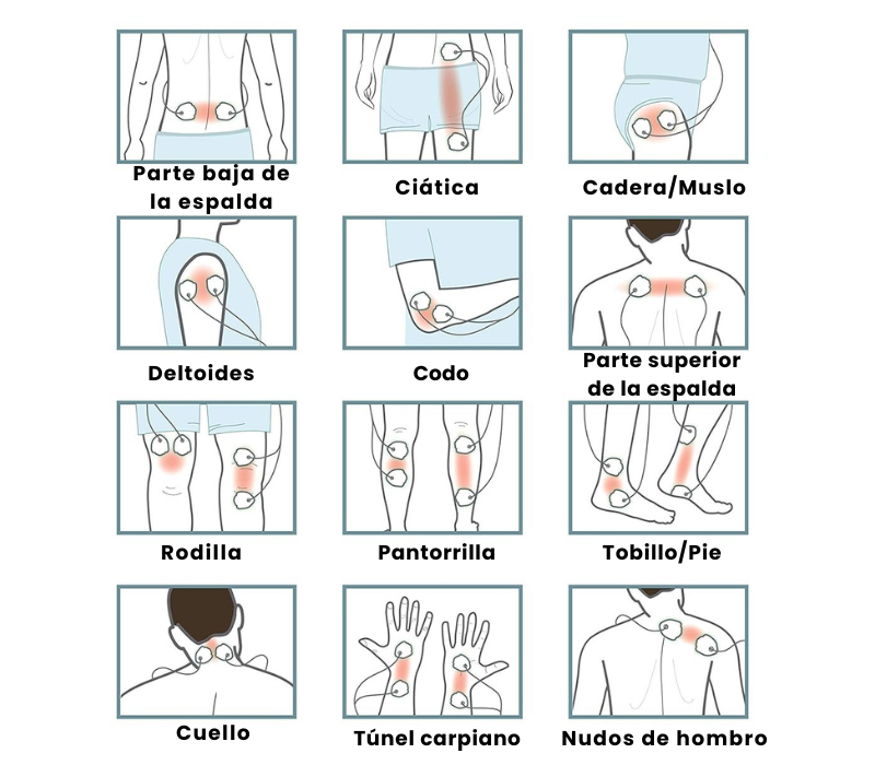 Terapia de TENS/EMS